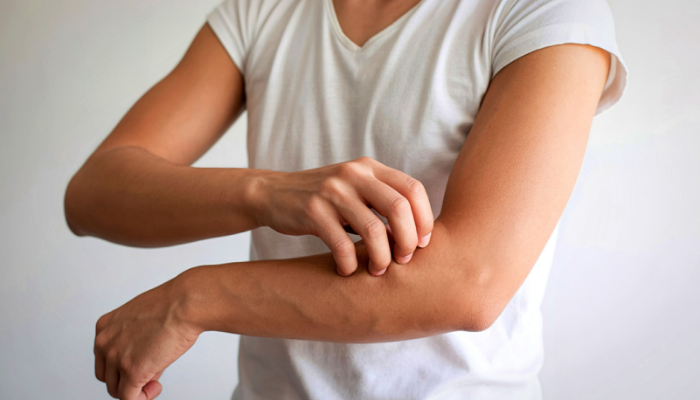 Intimate Irritation